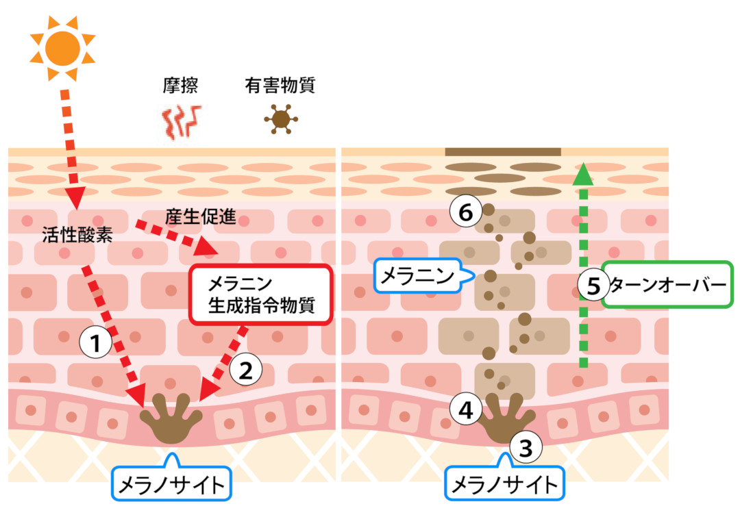 シミができるメカニズム