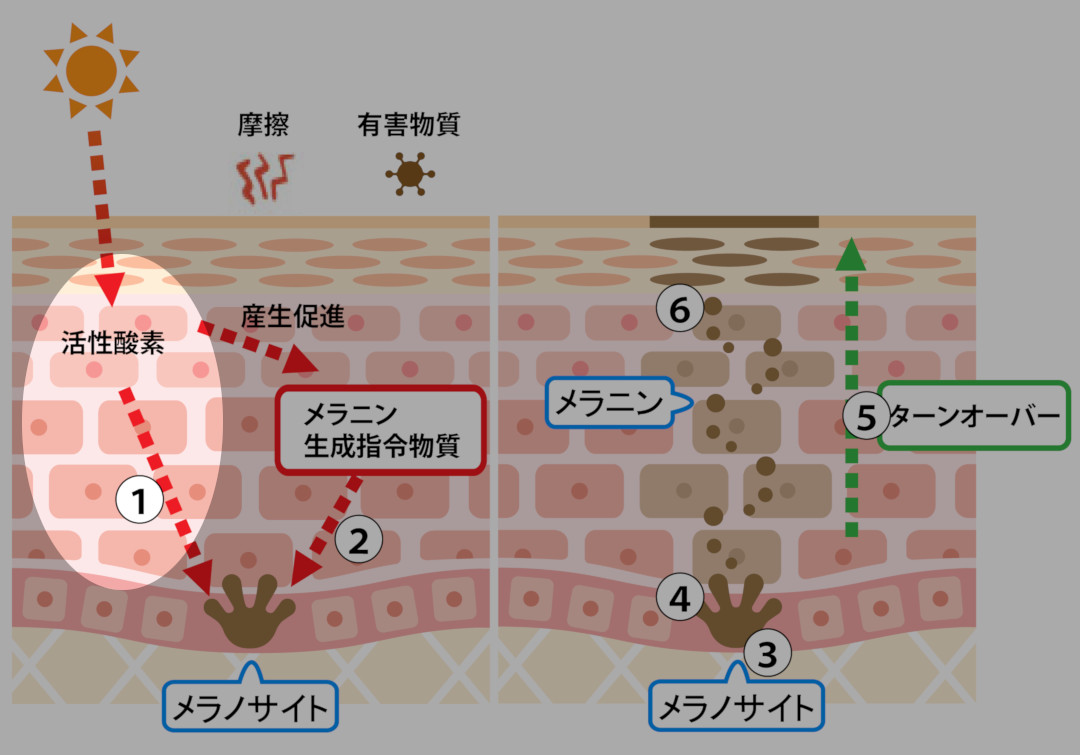 シミが出来るメカニズム1