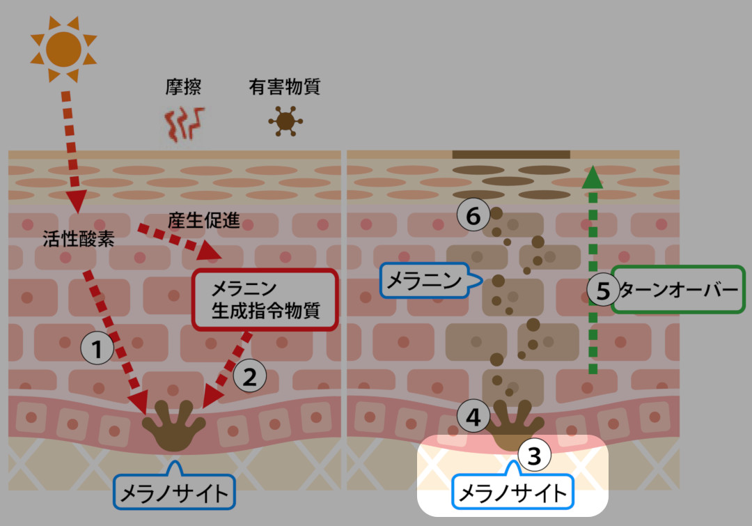 シミが出来るメカニズム3