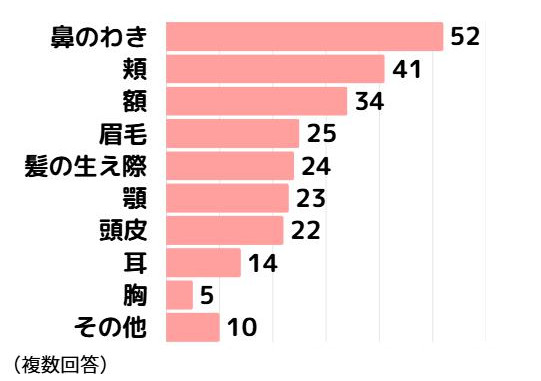 脂漏性皮膚炎アンケート3症状が出ている部位