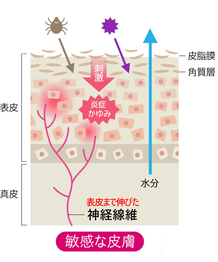 神経線維模式図＿敏感な肌