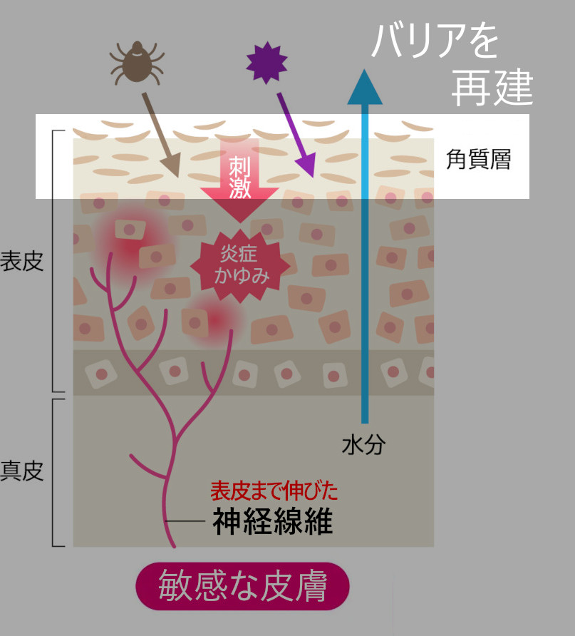 肌バリアの再建