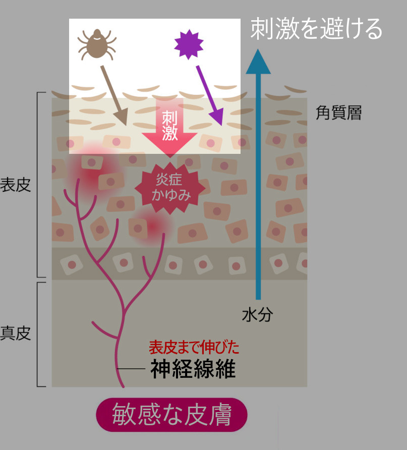 刺激を避ける