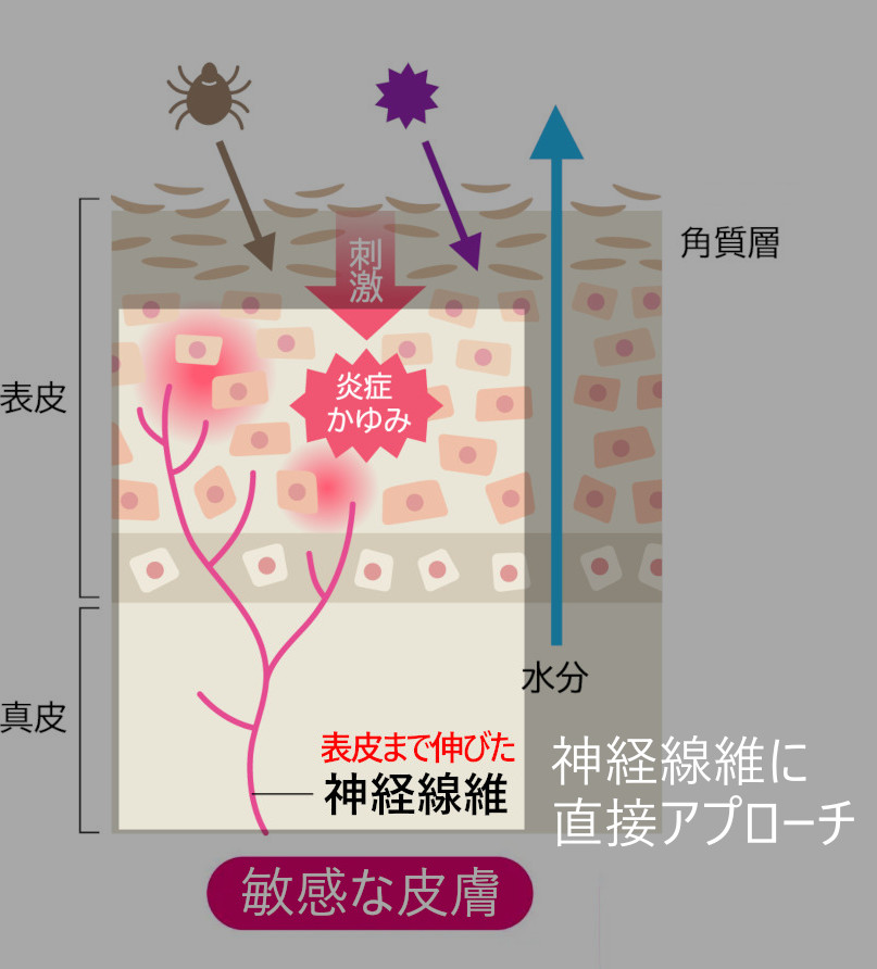 神経線維に直接アプローチ