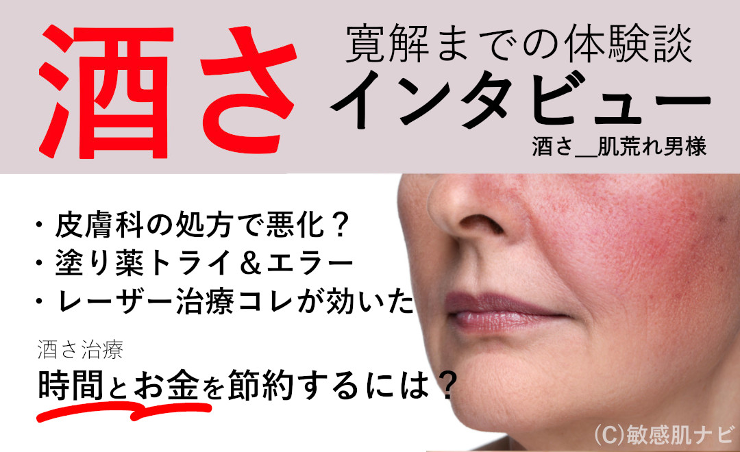 酒さインタビュー_酒さ肌荒れ男様