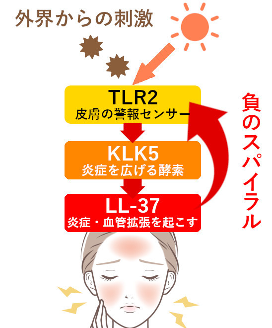 酒さの仕組みとアゼライン酸の効果